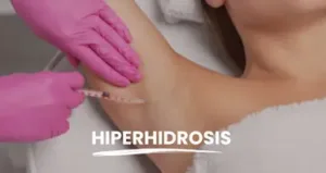 Hiperhidrosis - Clinica medicina estética Santa Pola