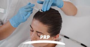 PRP Capilar - Clinica medicina estética Santa Pola