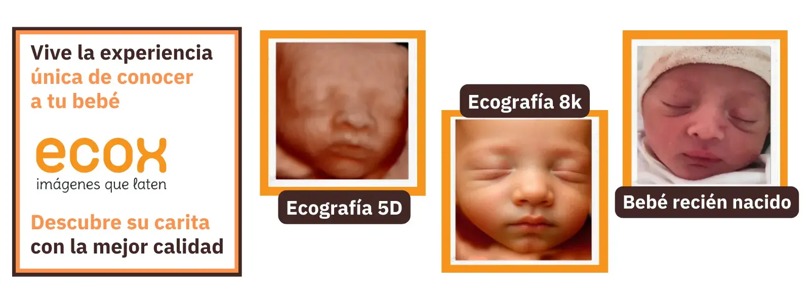 Ecografias 4D y 5D Ecox