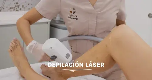 depilación láser