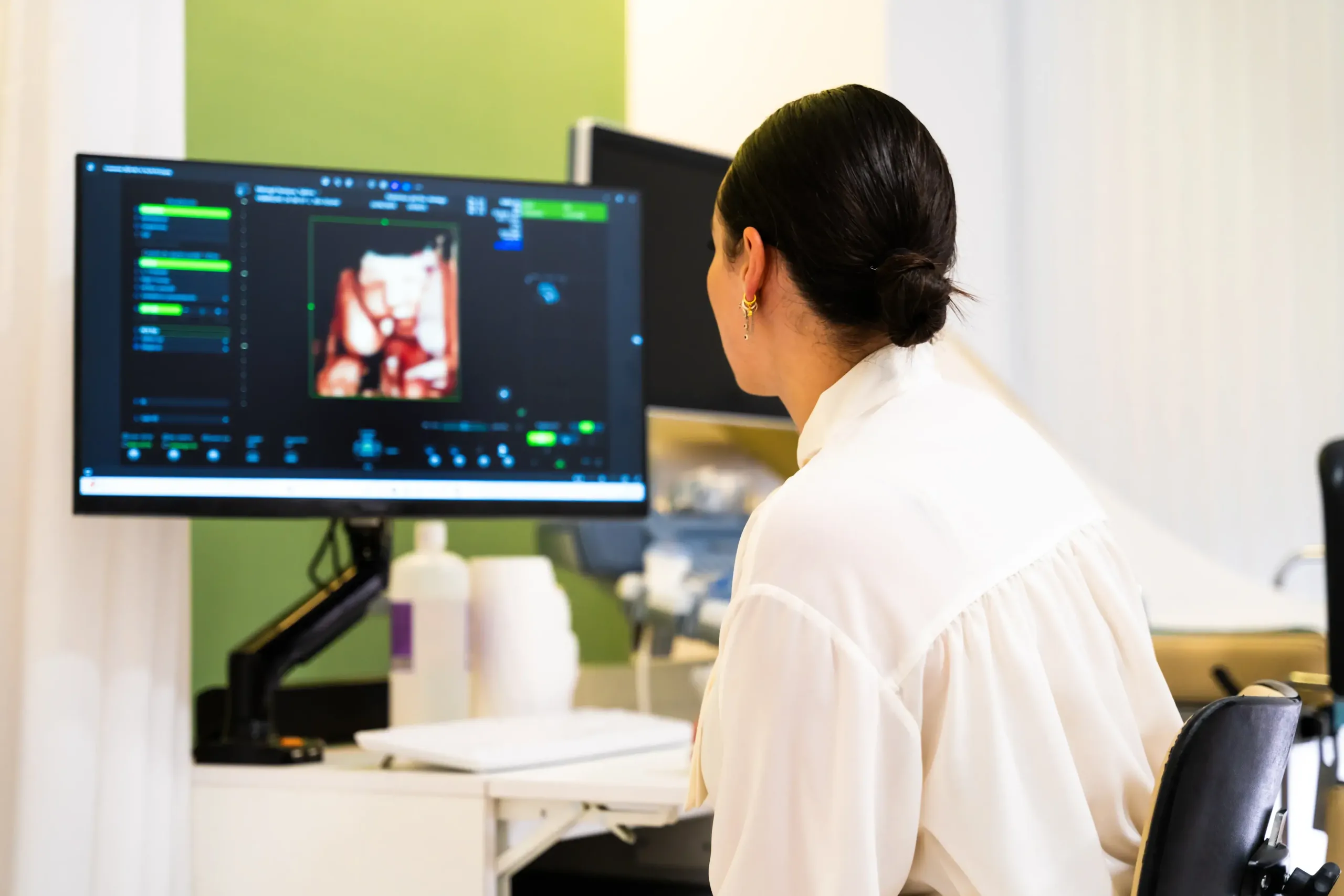 ecografia-ecox-santa-pola